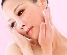 怎么去痘印好呢？去痘印方法介绍下嘛！我弟长好多痘心里很烦！ width=