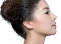 自体脂肪隆鼻缺点有哪些？万物都有两面，他也不例外！ width=