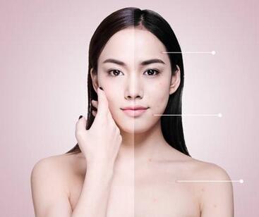【光子嫩肤能去斑吗？还有哪些关于光子嫩肤我们不知道的知识？！】