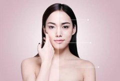光子嫩肤对皮肤有伤害吗？ width=
