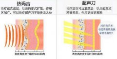 做一次thermage热玛吉要多少钱？ width=