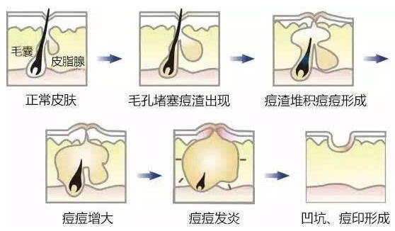 做果酸换肤需要多少钱？
