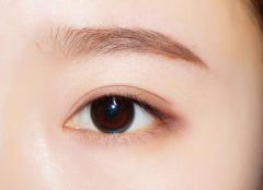 深圳做双眼皮加宽手术多少钱？ width=
