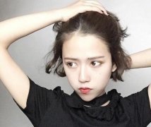 南京祛痣医院有哪些？祛痣多少钱？ width=