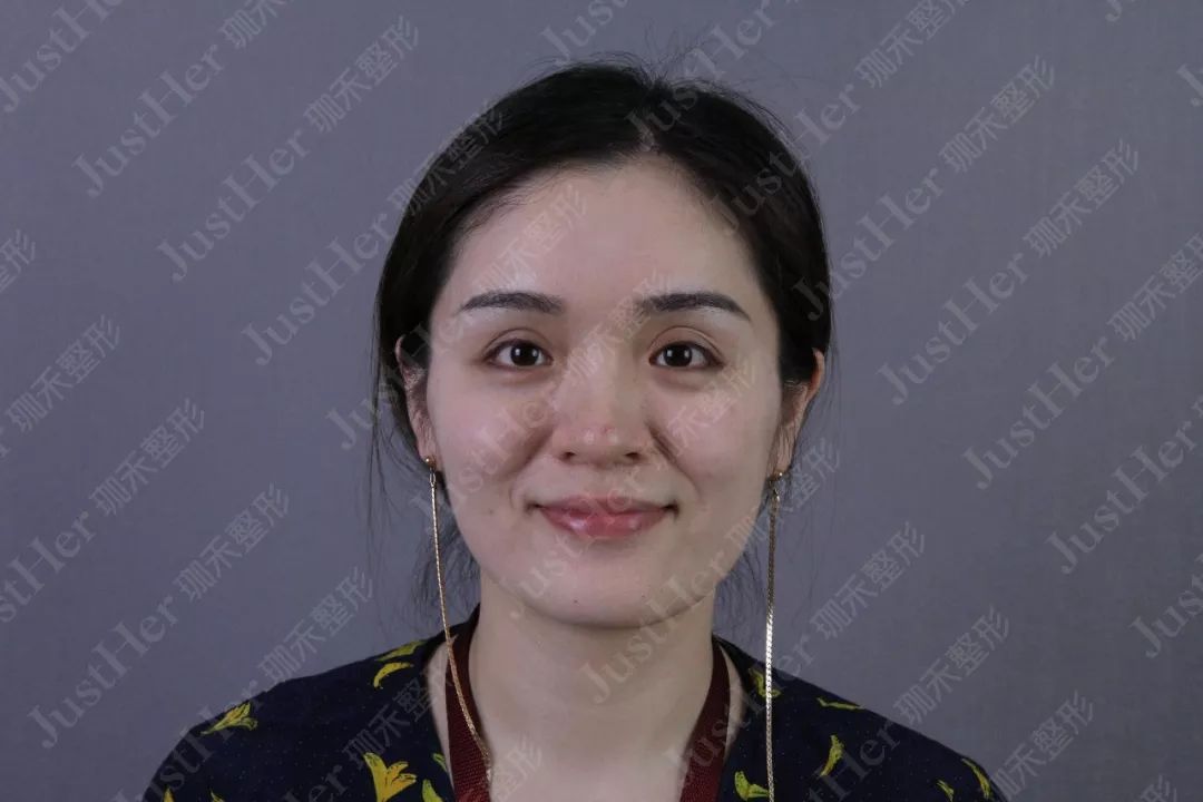 神秘大咖2019第一诊，刷新你的颜值新高度