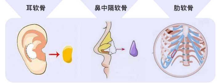 鼻头肥大鼻翼外扩怎么办？|鼻整形大咖李琳教授有话说