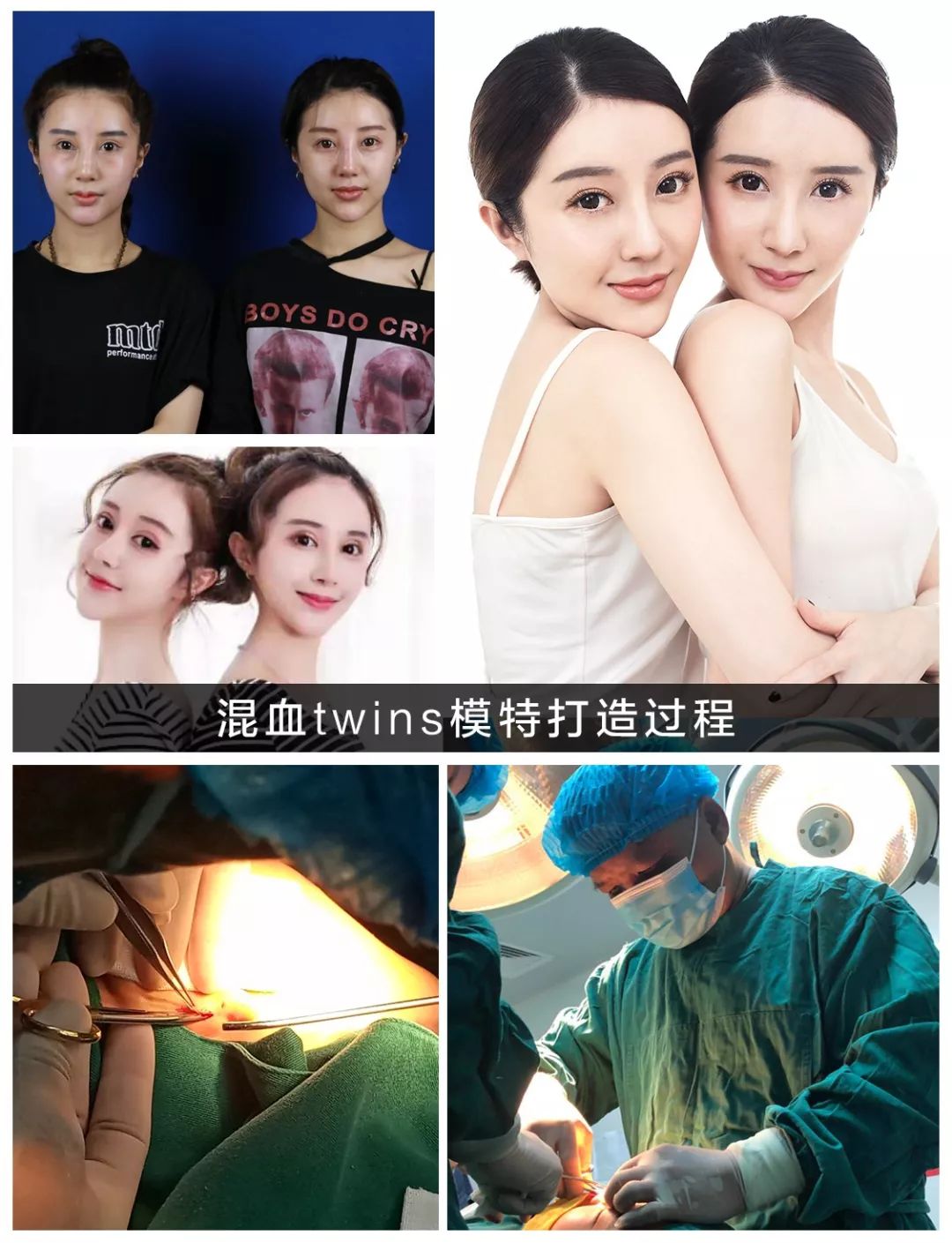鼻头肥大鼻翼外扩怎么办？|鼻整形大咖李琳教授有话说