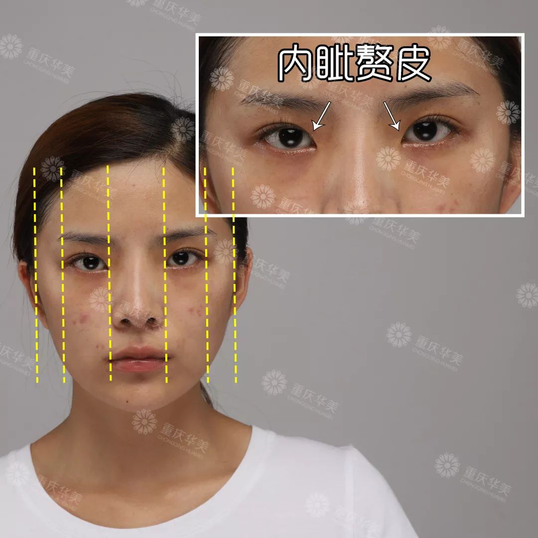波叔凉凉，《情圣2》撤档，里面可有号称全亚洲较美整形模板啊！