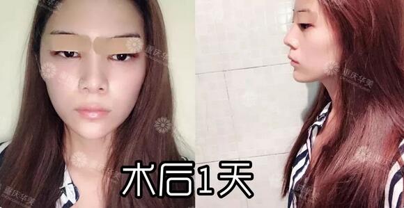 波叔凉凉，《情圣2》撤档，里面可有号称全亚洲较美整形模板啊！