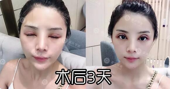 波叔凉凉，《情圣2》撤档，里面可有号称全亚洲较美整形模板啊！