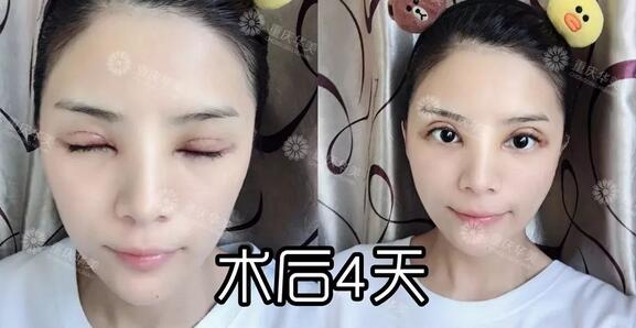 波叔凉凉，《情圣2》撤档，里面可有号称全亚洲较美整形模板啊！