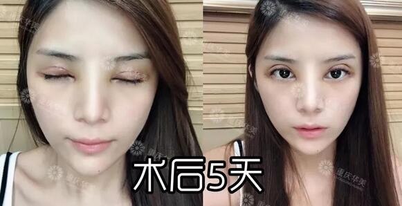波叔凉凉，《情圣2》撤档，里面可有号称全亚洲较美整形模板啊！