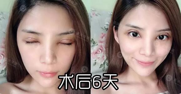 波叔凉凉，《情圣2》撤档，里面可有号称全亚洲较美整形模板啊！