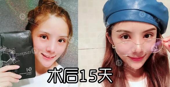 波叔凉凉，《情圣2》撤档，里面可有号称全亚洲较美整形模板啊！