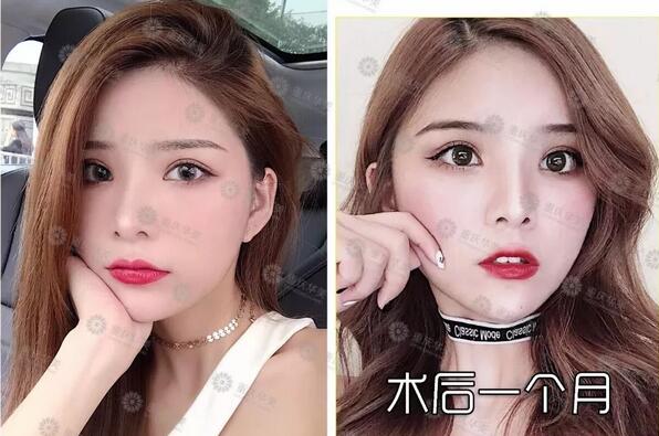 波叔凉凉，《情圣2》撤档，里面可有号称全亚洲较美整形模板啊！