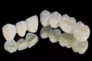 10多块就能做牙齿贴面，还能逼真果？