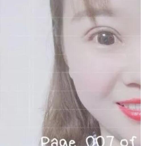 济南悦荟丽格整形说：校园女神，往往只需要一个双眼皮！