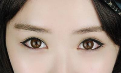 济南韩式微创开眼角大概多少钱?