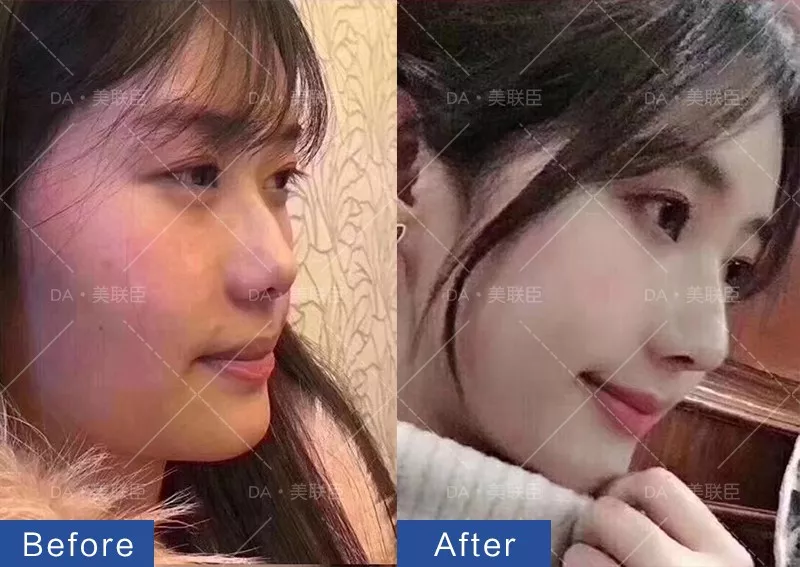你过得好不好，看脸就知道了.春节聚会、相亲，这些准备现在就要做起来了!