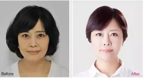 你过得好不好，看脸就知道了.春节聚会、相亲，这些准备现在就要做起来了!