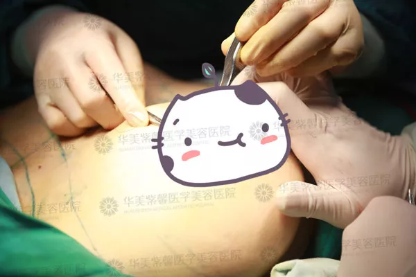 【隆胸后胸部硬如馒头，是包膜挛缩吗？】