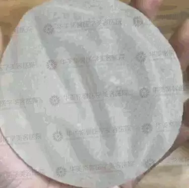 【隆胸后胸部硬如馒头，是包膜挛缩吗？】