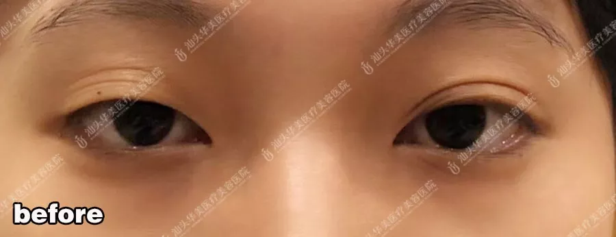 辣妈孙怡赶超国民闺女，成眼部较显老的90后女星？！