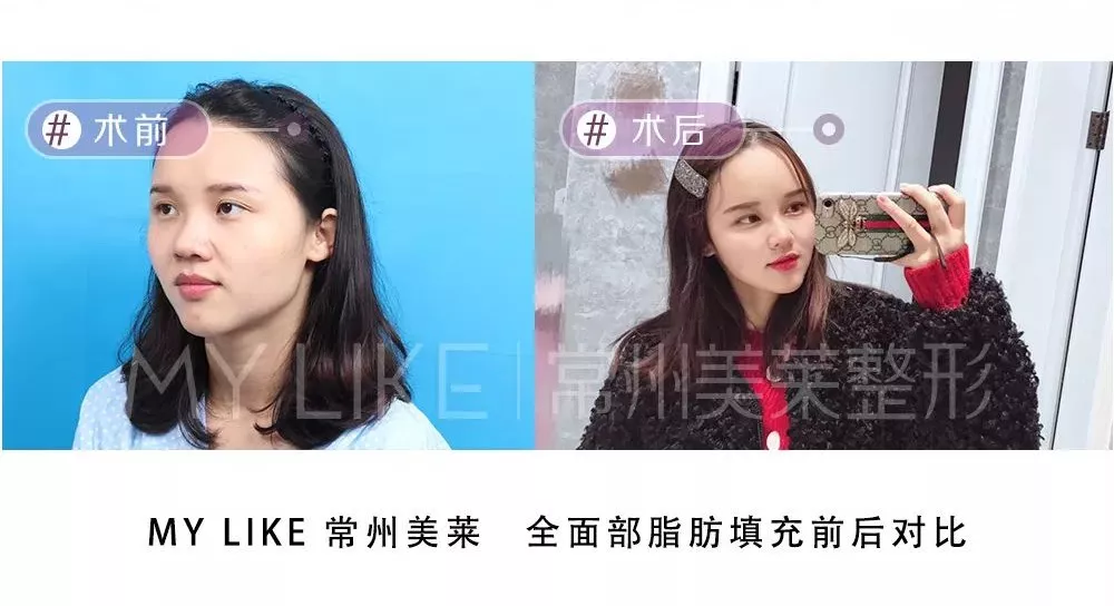 如何满分回答女票的这些“送命题”？快来看看标准答案！
