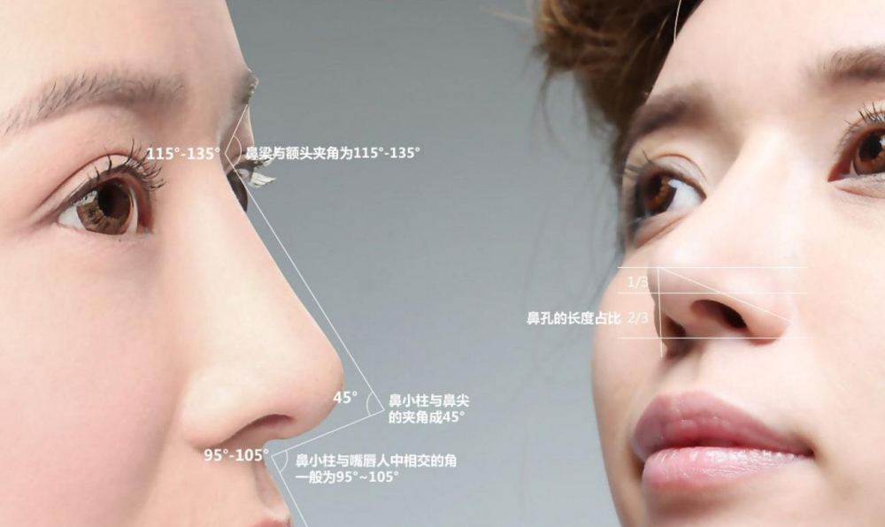鼻小柱延长的两种手术方法