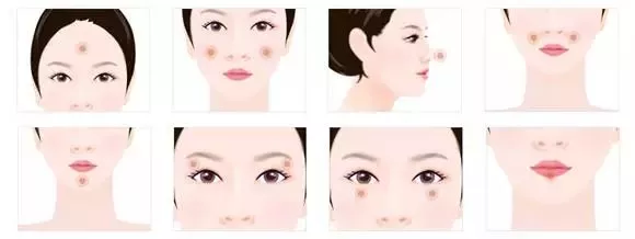 自体脂肪面部填充有哪些优势？我悄悄告诉你~
