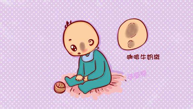 激光去胎记恢复白皙光滑肌肤
