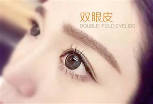【肿泡眼可以做双眼皮手术吗？需要注意什么？】