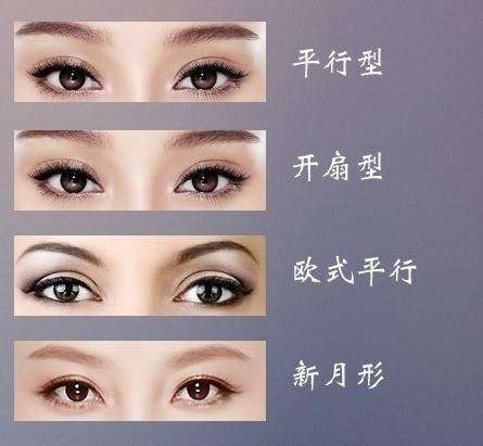 【肿泡眼可以做双眼皮手术吗？需要注意什么？】