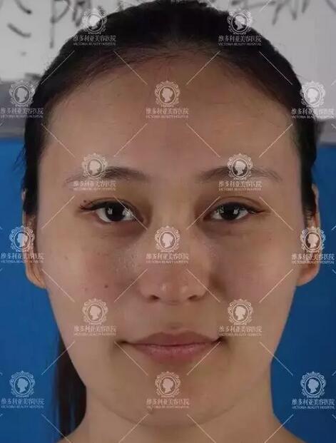 脸部紧致提升、抗皱紧肤这些女明星都在做，来看看图片~