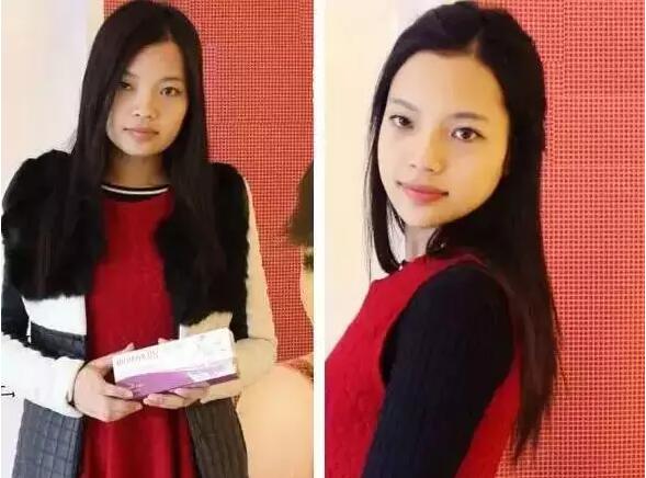 脸部紧致提升、抗皱紧肤这些女明星都在做，来看看图片~