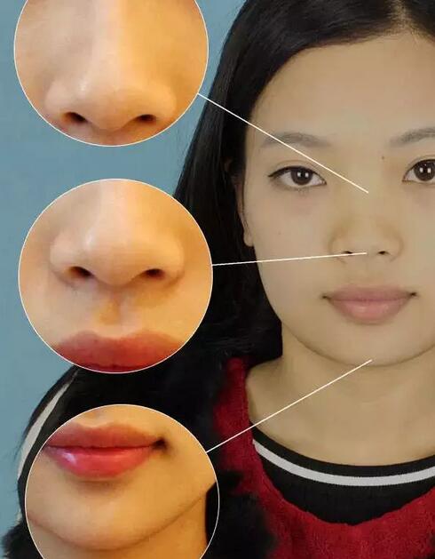 脸部紧致提升、抗皱紧肤这些女明星都在做，来看看图片~