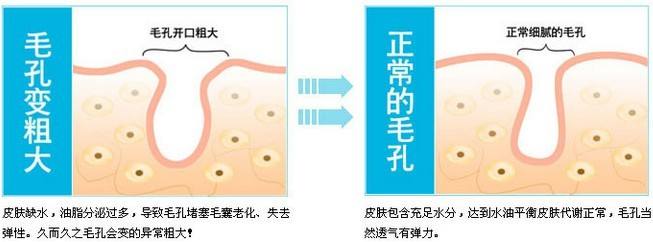 毛孔粗大这么做 再也不用担心毛孔问题啦