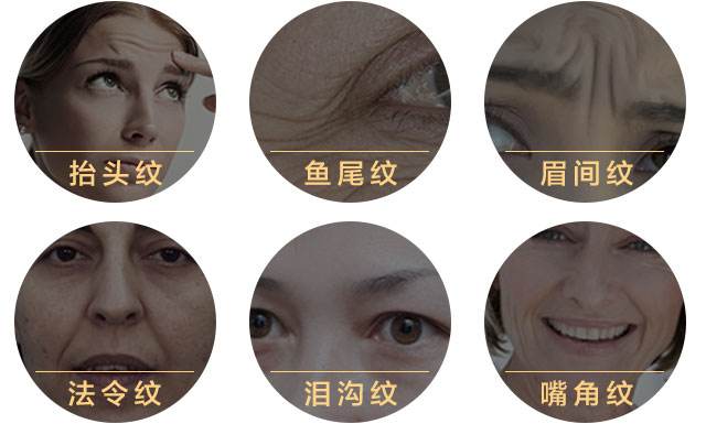 皱纹出现的先后你属于几岁肌肤