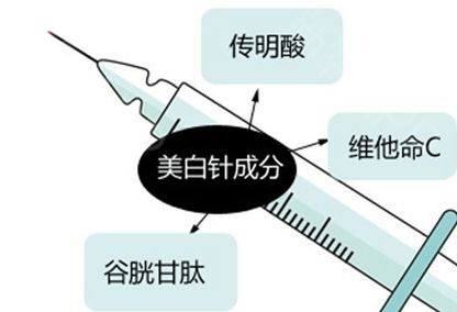 注射美白 穿出时尚感