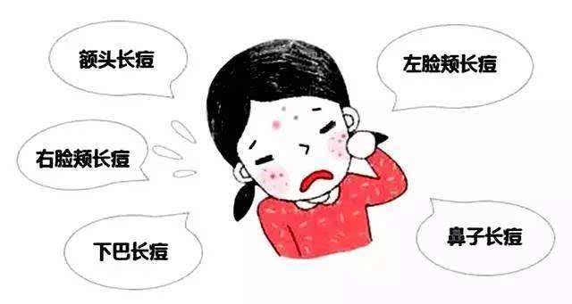 激光祛青春痘改良肌肤无可挑剔