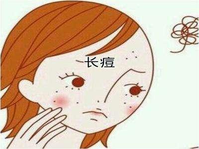 激光祛青春痘改良肌肤无可挑剔