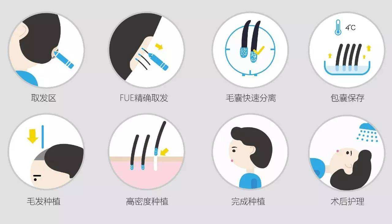 除了植发以外的发量稀疏拯救方法