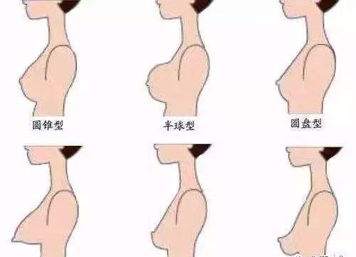 胸小隆胸用什么材料好