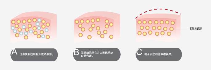 冷冻溶脂这种高大上操作的原理和果