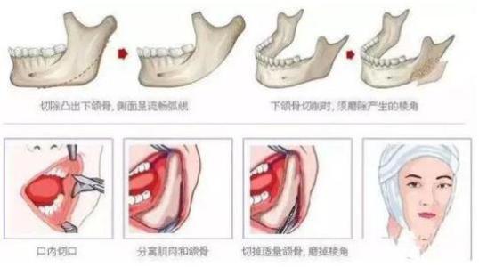磨骨瘦脸冬天才是佳季