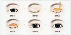 切开法做双眼皮有什么优势 width=