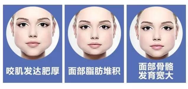 注射瘦脸会疼吗 术后变成精致小脸