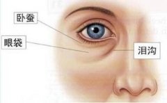 五种去眼袋方法各有不同的特点 width=