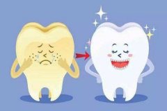 牙齿美白 不可忽视的问题 width=