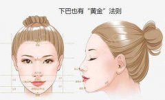 自体脂肪丰下巴塑造立体轮廓 width=